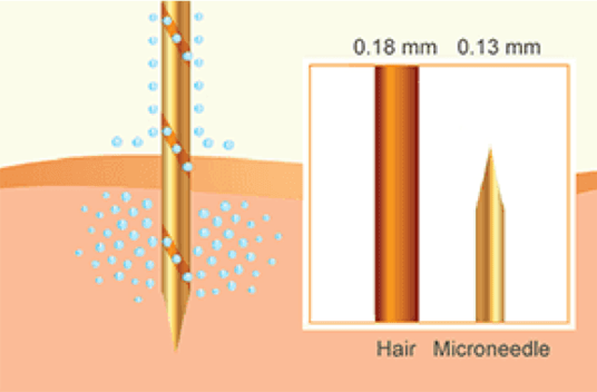 injectables image 11