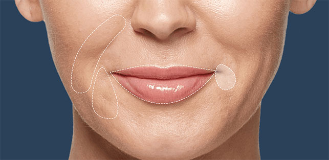 injectables image 2